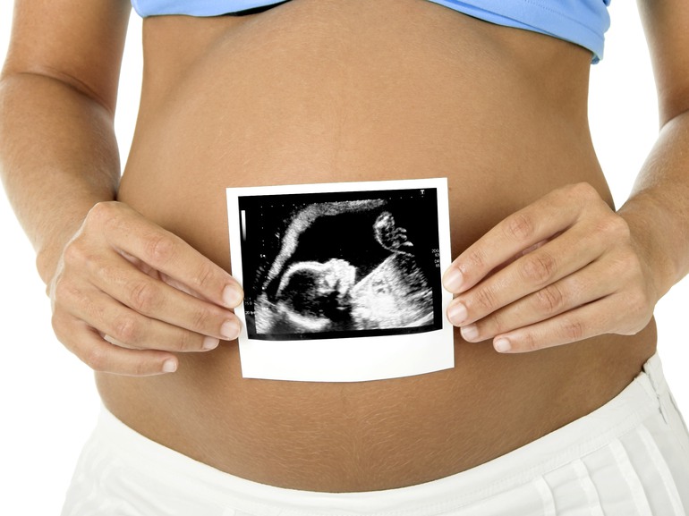 En närbild på en gravid kvinna som håller en ultraljudsbild framför sin stora fina mage.
