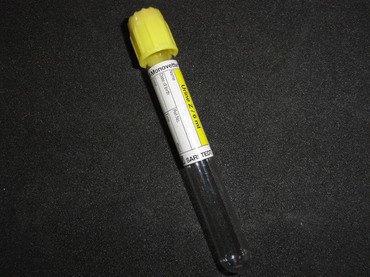 Urinrör (gul propp med röd topp)